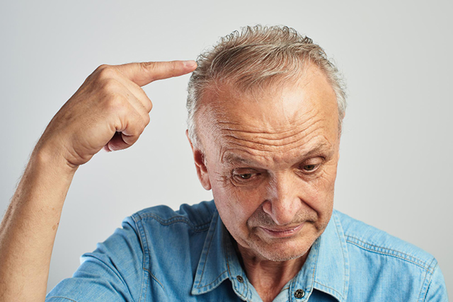 Quel est le rôle de la zone donneuse dans le succès de la greffe de cheveux